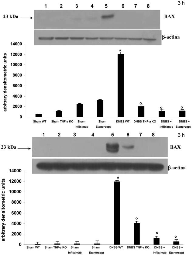 Etanercept Vs Infliximab Mechanism Of Action