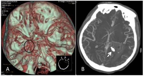 Int J Med Sci Image