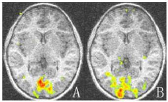 Int J Med Sci Image