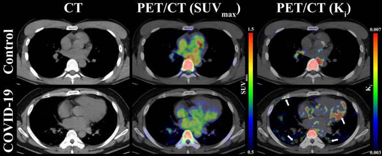 The imaging quantification of multiple organs by dynamic 18F-FDG PET/CT ...
