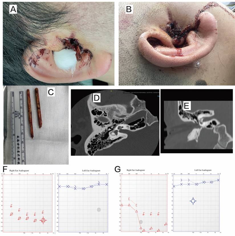 Int J Med Sci Image