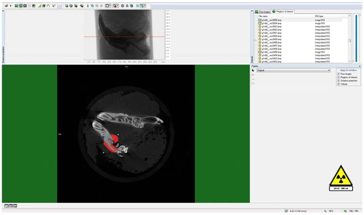 Int J Med Sci Image