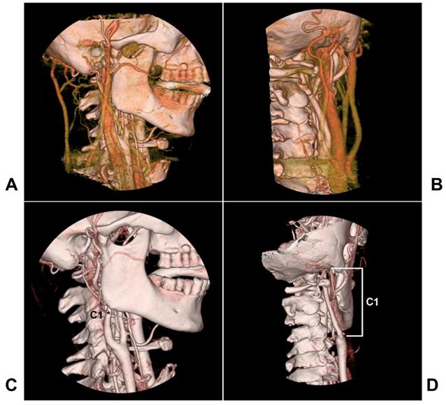 未使用・未開封品】External Carotid Artery: Imaging Anatomy Atlas