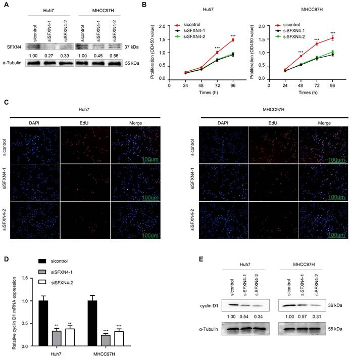 Comprehensive Analysis of Sideroflexin 4 in Hepatocellular Carcinoma by ...