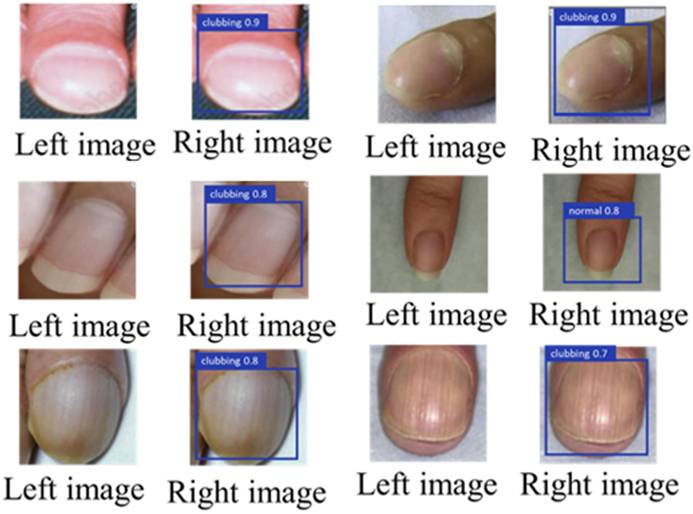 Int J Med Sci Image